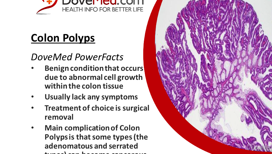 Colon Polyps