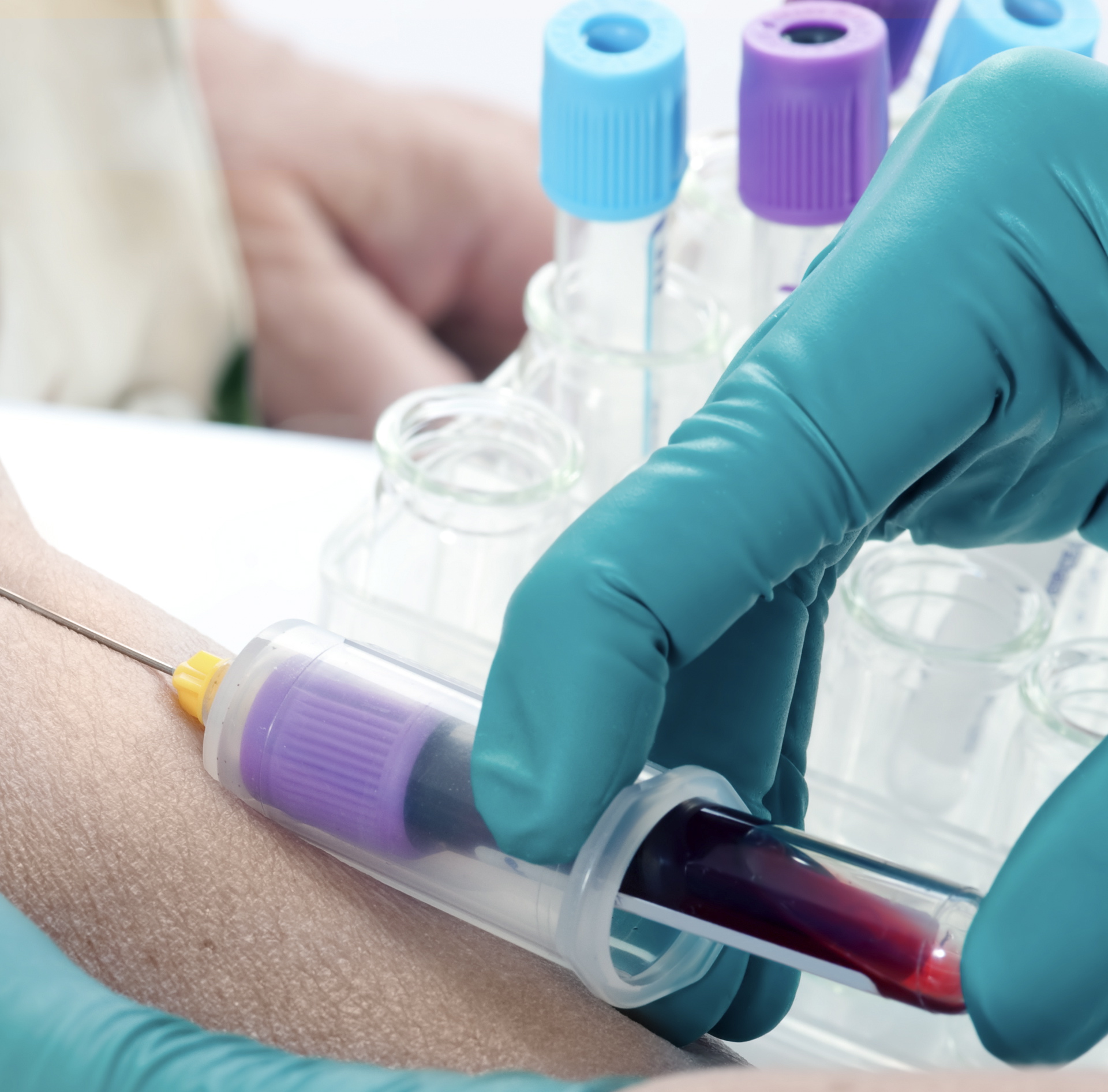 Measles and Mumps Blood Test