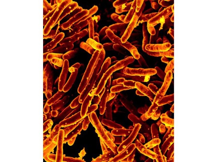 tb-screening-test-interferon-gamma-release-assays-quantiferon-test