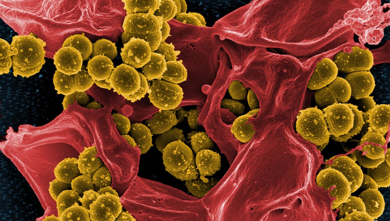 MRSA Screening Test