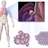 Lung Cancer.