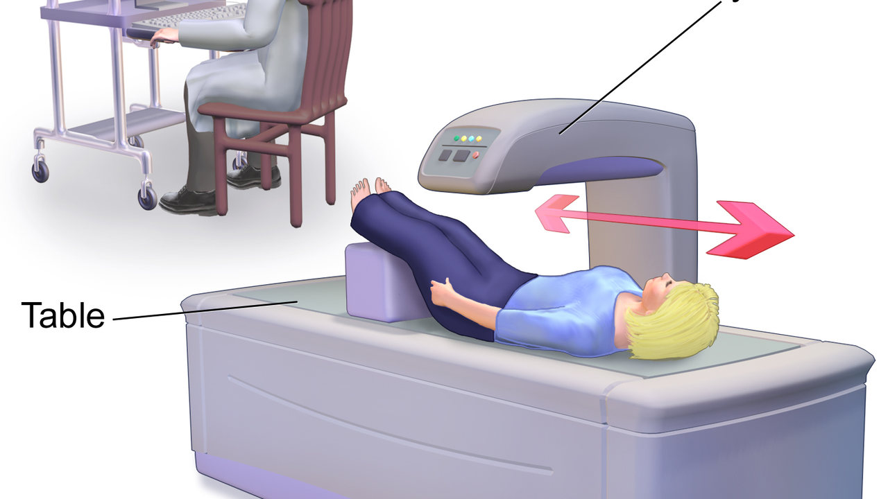 bone-densitometry