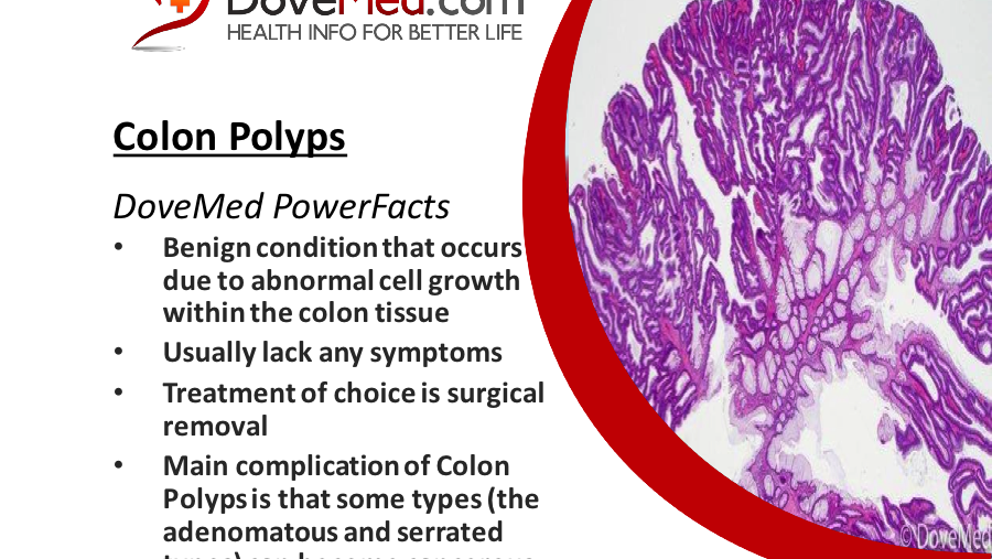 Colon Polyps