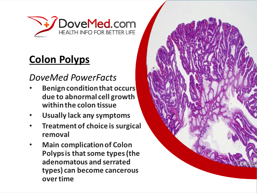 colon-polyps