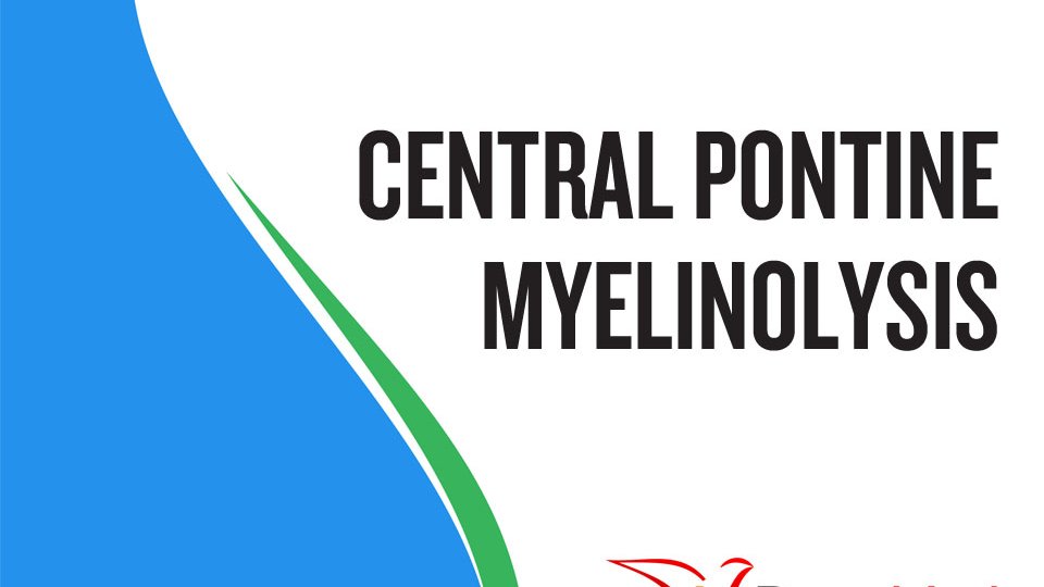 Guillain Barre Syndrome Csf Wbc / Delaware Afp Edition 14