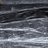 Ultrasound image depicting a large large trhombosis (potetnially one amenable to catether related thrombolsyis).