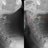 X-ray of the cervical spine showing a Cervical Fracture. Left without, right with annotation. Clearly can be seen that C2 (red outline) is moved forward with respect to C3 (blue outline).