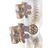 Illustration of Spinal disc herniation.