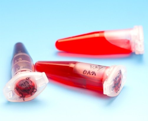 Clozapine Drug Levels