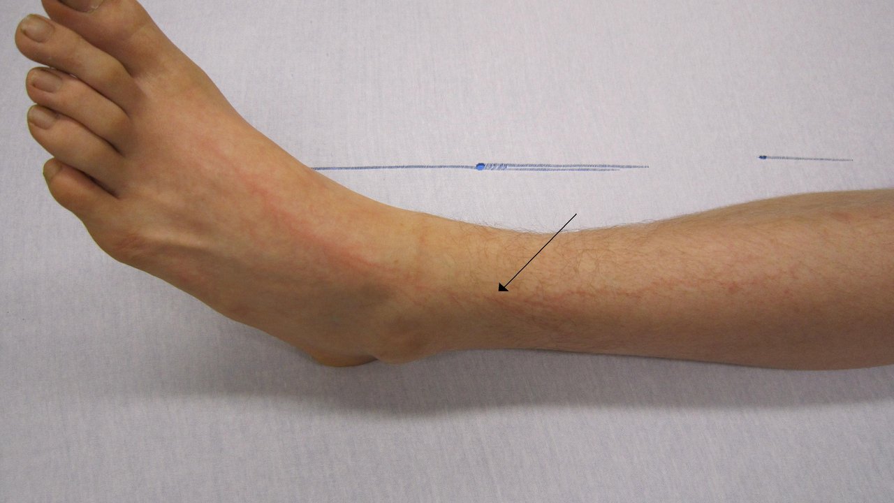 First Aid for Electric Shock