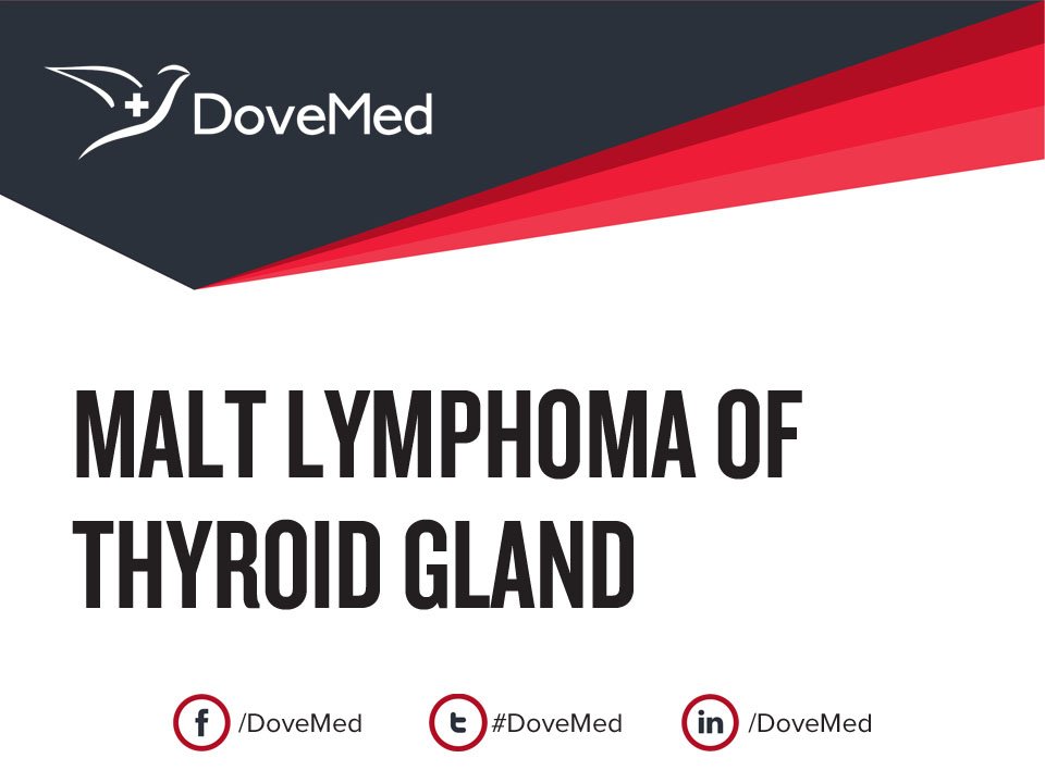 MALT Lymphoma of Thyroid Gland