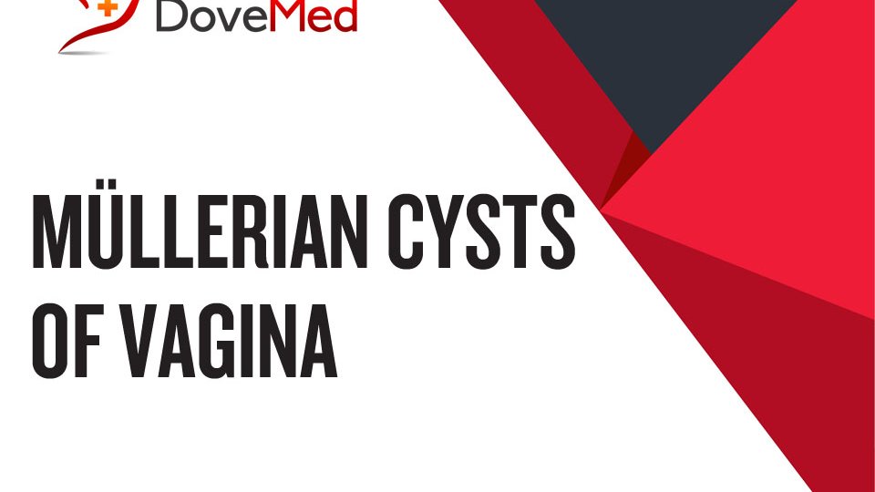 Müllerian Cysts Of Vagina