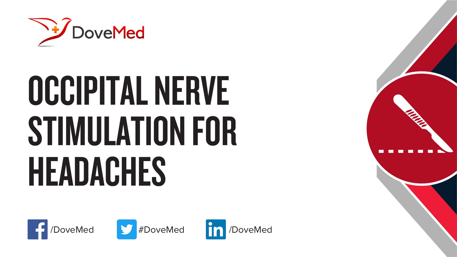 Occipital Nerve Stimulation For Headaches 0039