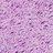 Microscopic pathology image showing a high grade spindle sarcoma.