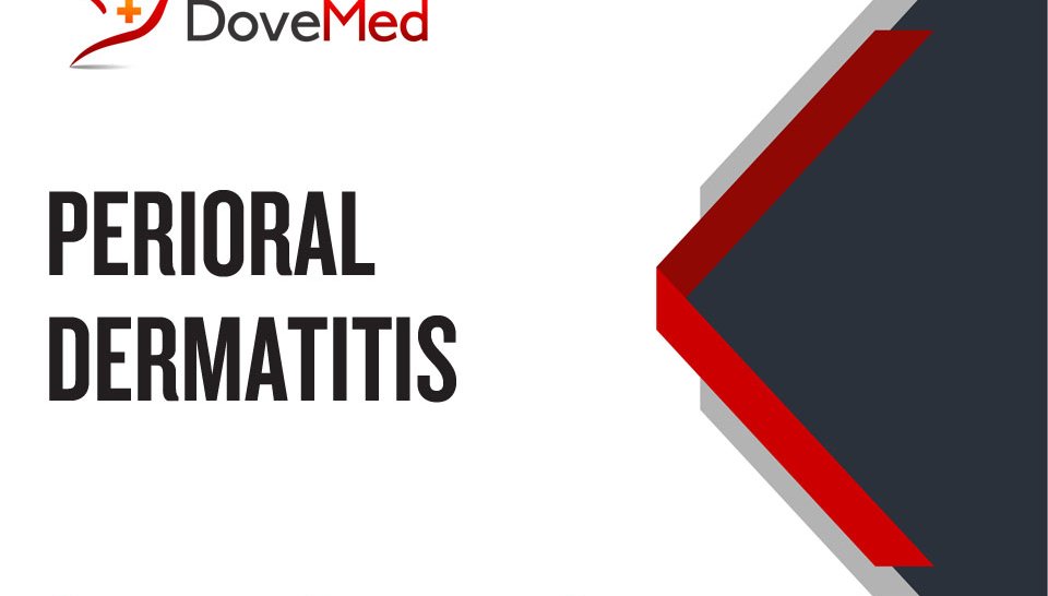 Perioral Dermatitis