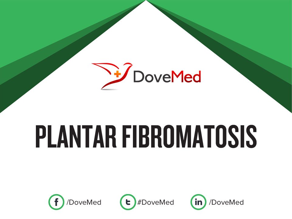 Plantar Fibromatosis