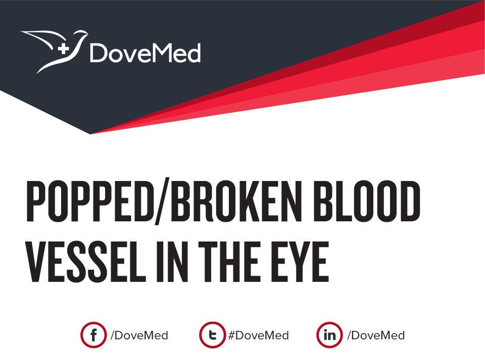 Popped/Broken Blood Vessel in the Eye