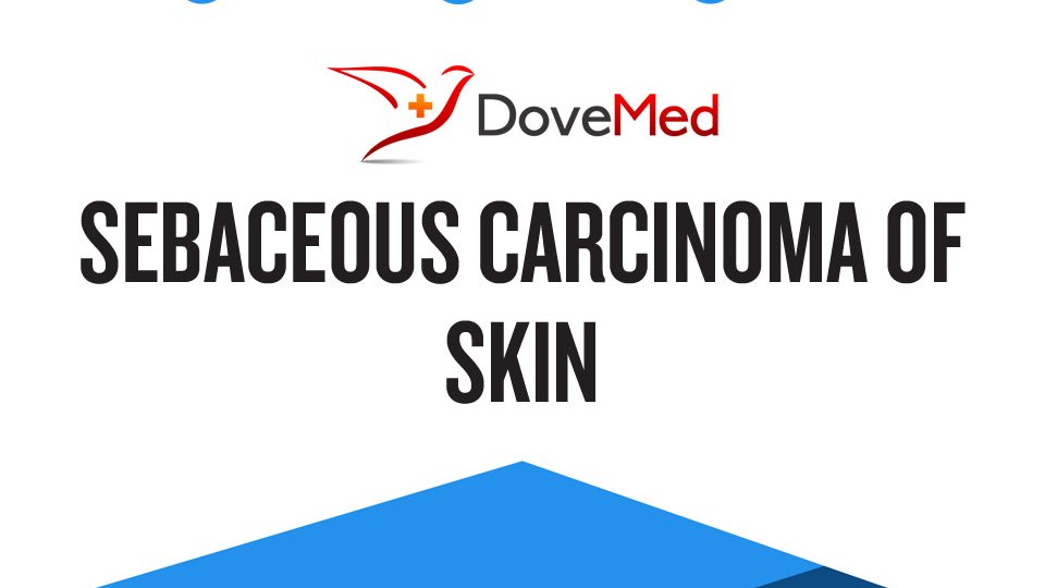 Sebaceous Carcinoma of Skin