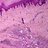 Microscopic pathology image showing Angiomatosis cutis. 4X.