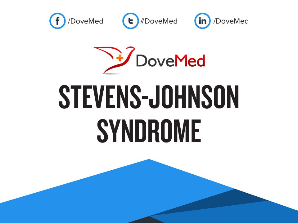 steven johnson syndrome introduction and diagnosis Stevens-johnson syndrome symptoms, diagnosis & treatment from the merck manuals introduction to hypersensitivity and inflammatory skin disorders. steven johnson syndrome introduction and diagnosis Stevens-johnson syndrome symptoms, diagnosis & treatment from the merck manuals introduction to hypersensitivity and inflammatory skin disorders.