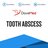 Tooth Abscess.