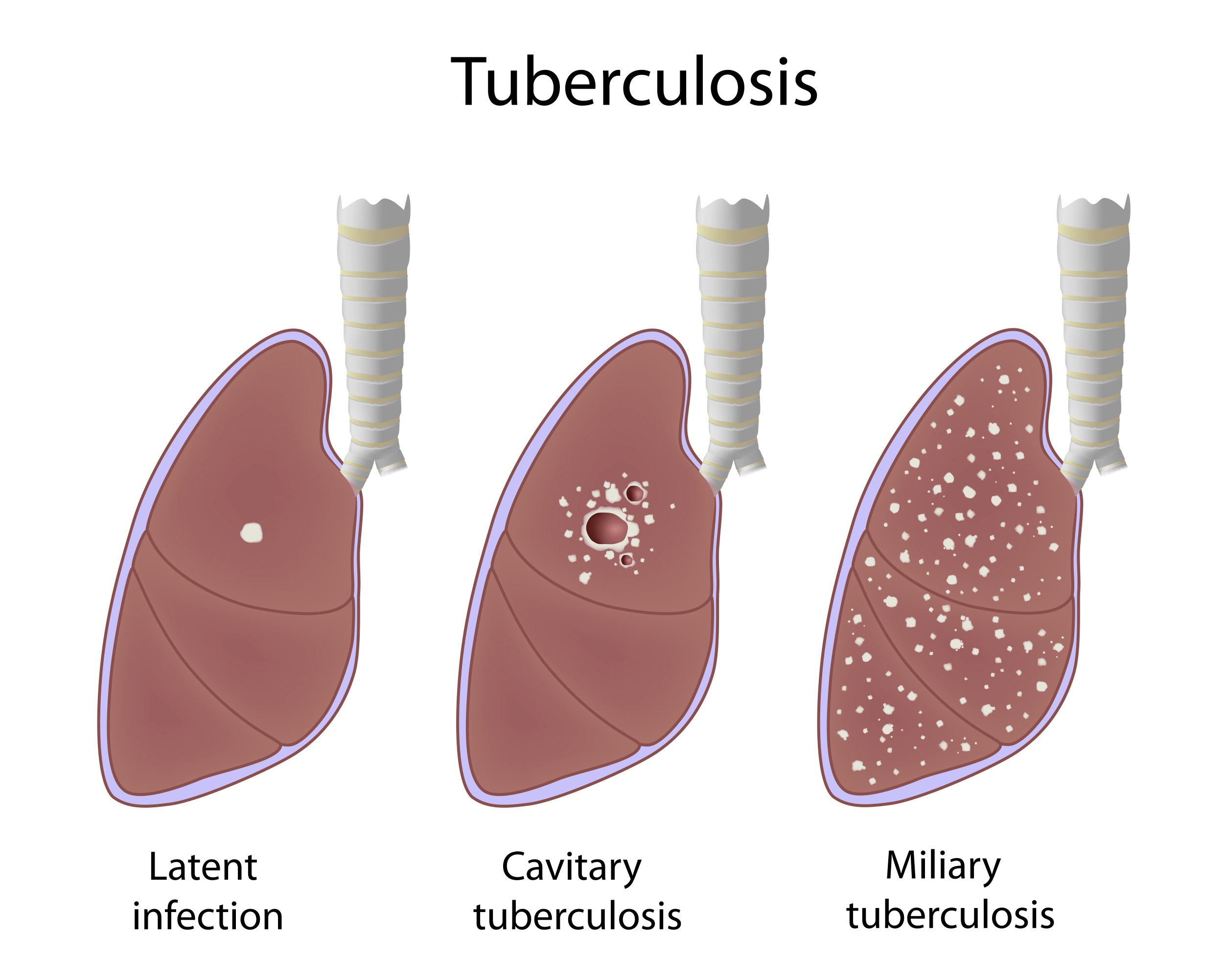 Does Tb Go Dormant