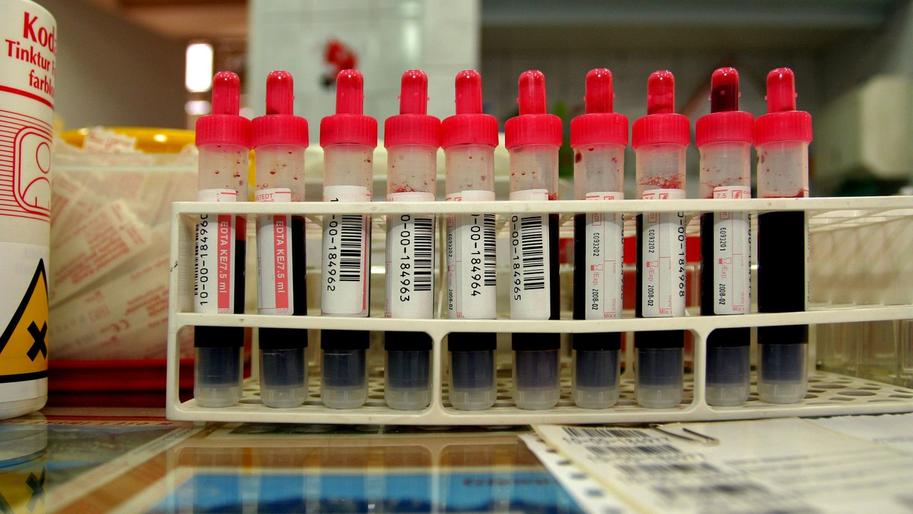 Comprehensive Metabolic Panel Blood Test