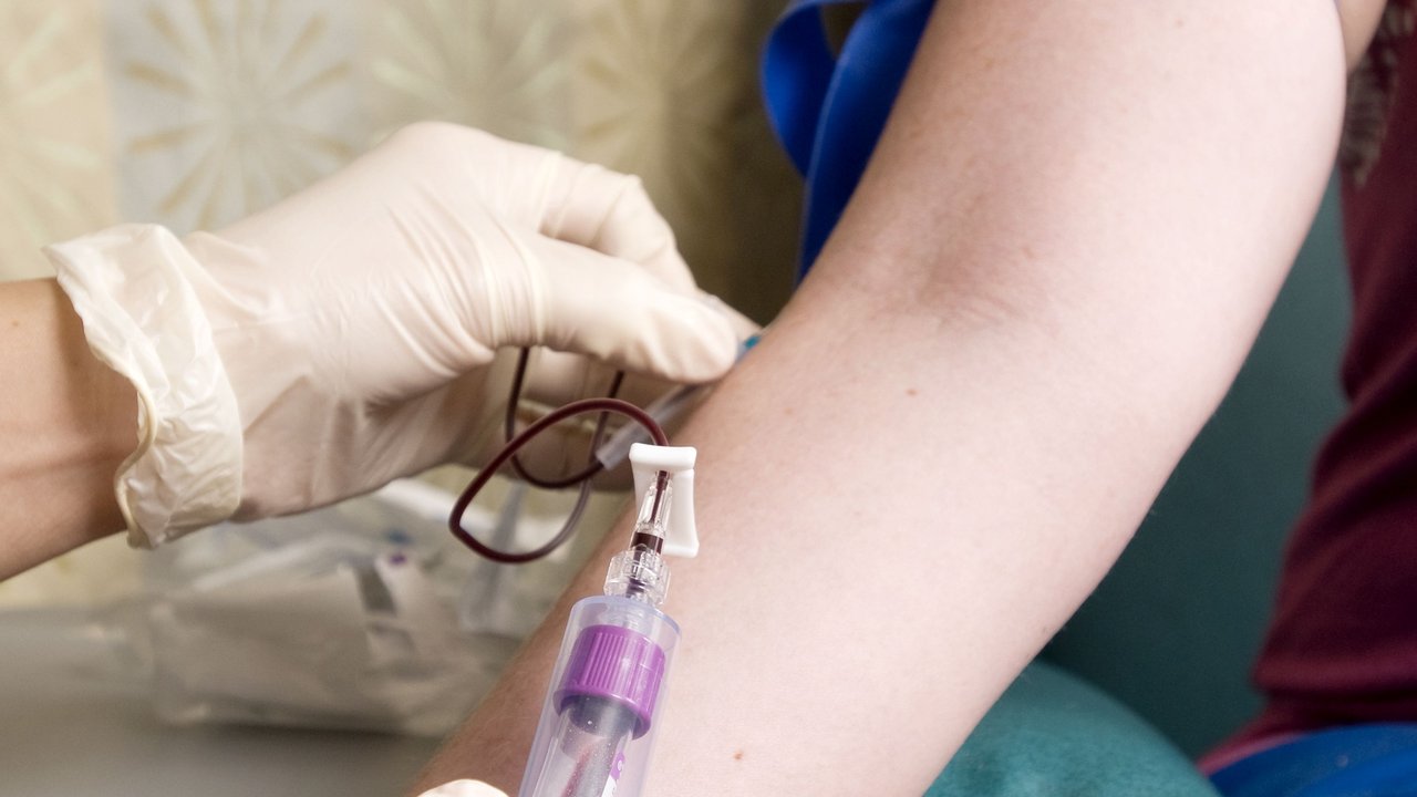 Prealbumin Blood Test