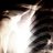 X-ray of the Shoulder Joint Showing Grade I AC joint dislocation aka Type 1 AC separation.