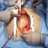 Two surgeons for cardiac surgery. The surgeon points to the beating heart. Documentary photography.