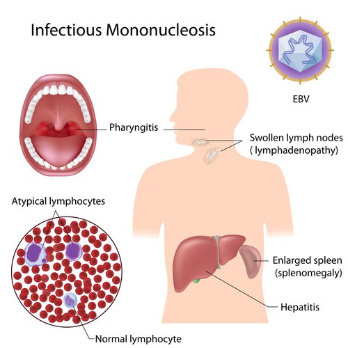 EpsteinBarr Virus (EBV) Antibodies Blood Test