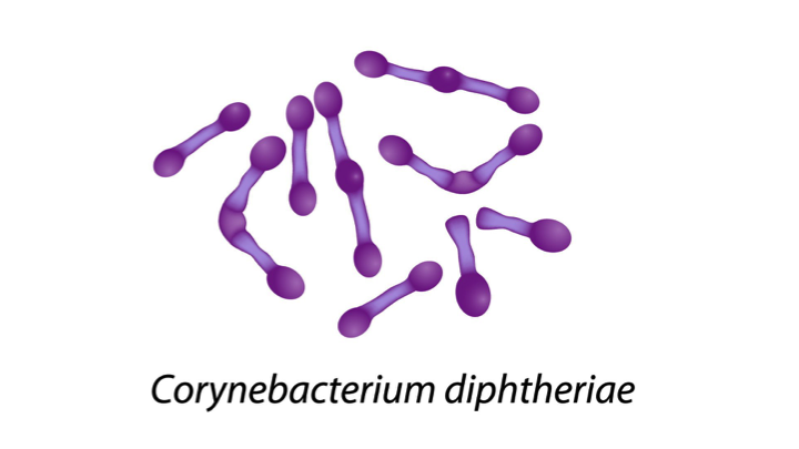 Diphtheria