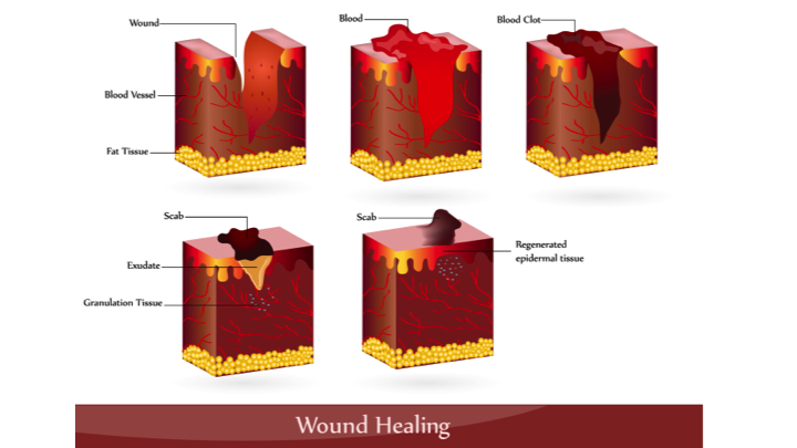 Are Puncture Wounds Dangerous