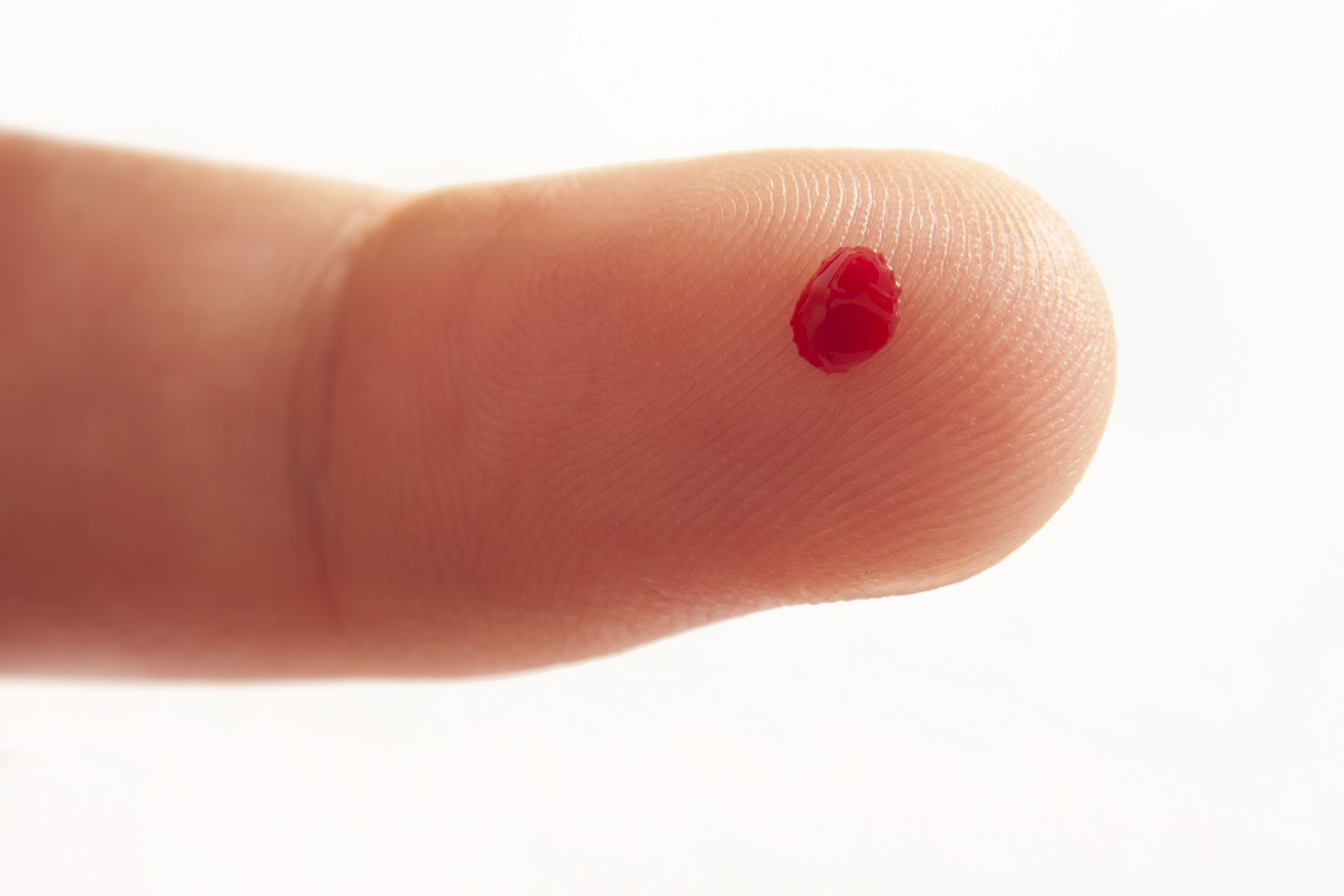 Blood Test Results Vary From Drop To Drop In Fingerprick Tests