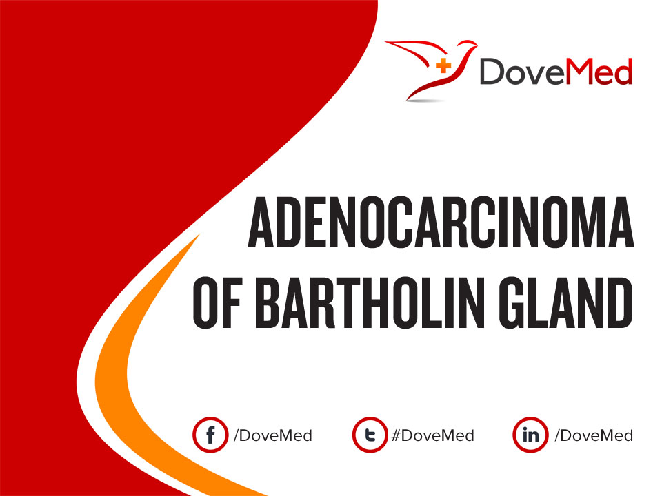Adenocarcinoma of Bartholin Gland