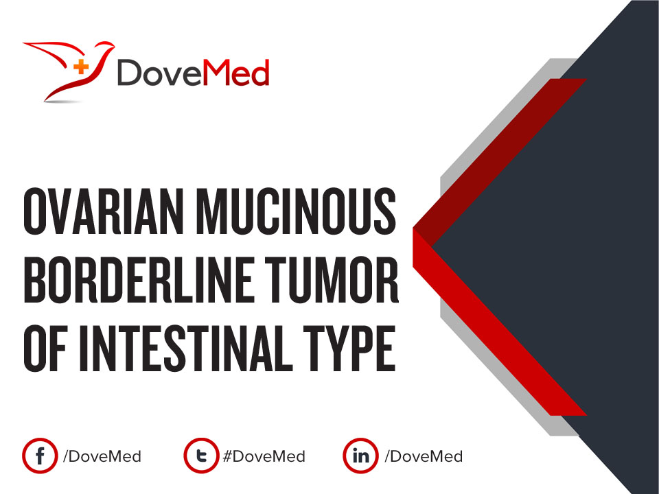 right ovarian mucinous borderline tumor icd 10