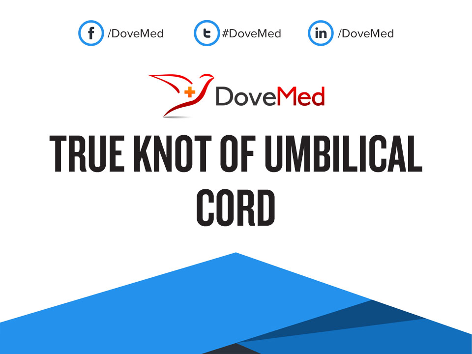 True Knot of Umbilical Cord